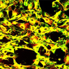 TrkBシグナル伝達が網膜変性および再生の際に果たすグリアおよびニューロン特異的機能