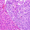 マイクロRNA122はα-フェトプロテイン発現の主要な調節因子であり、肝細胞がんの悪性度に影響を与える