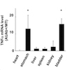 抗尿路上皮抗体を発現するBALB/c-Fcgr2b-/- Pdcd1-/-マウスは自己免疫性膀胱炎の新たなモデルとなる