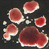 低酸素誘導因子-1αはVegfを欠損した膵島細胞腫瘍の浸潤性の表現型に必要である