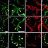 ゼブラフィッシュ心臓の血行動態依存的な弁形成はmiR-21の血流依存的発現によって仲介される