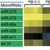 ピロリ菌慢性感染の際にはmiR-210のエピジェネティックなサイレンシングが消化管上皮の増殖を促進する