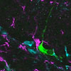 ミクログリアのTLR9シグナリングは成熟海馬の痙攣誘発性異常神経新生を軽減する
