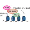 TRIM29は損傷を受けたクロマチンへのDNA修復関連タンパク質の集積を調節する
