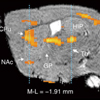 定量的活動依存性マンガン造影MRIで判定されるマウスのパーキンソン病重篤度