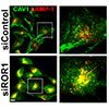 ROR1はcavin-1とcaveolin-1の足場として働きカベオラと生存シグナルを維持する