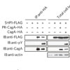 宿主SHP1ホスファターゼはピロリ菌（Helicobacter pylori）CagAの発がん活性に対抗するが、その発現はエプスタイン・バーウイルスにより抑制されうる