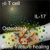 IL-17を産生するγδT細胞は骨再生を促進する