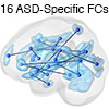 成人の自閉スペクトラム症を少数の異常な脳領域間結合で予測