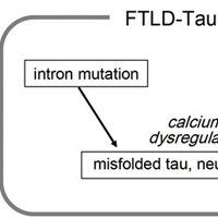 カルシウム制御異常はFTLD患者由来のiPS細胞から作製したニューロンにおける神経変性の原因となる