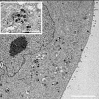 浸潤性膵管癌においてmicroRNA-155はエクソソーム合成を調整しゲムシタビン耐性を促進する