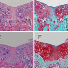 ガングリオシドの欠損はマウスにおいて関節軟骨の修復を亢進する