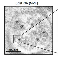 エキソソームは細胞から有害なDNAを排出することによって細胞の恒常性を維持する