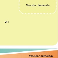 血管性認知障害