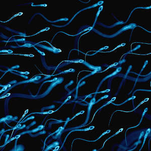 Routine genetic screening could reveal previously overlooked factors that contribute to male infertility by impeding the production of functional sperm cells.