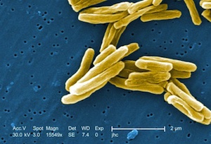 The tuberculosis bacteria steals human compounds to build its own cell walls