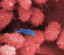 走査型電子顕微鏡で撮影された、マウスの肝臓内血管で成長する感染5日後のトリパノソーマの疑似カラー画像。