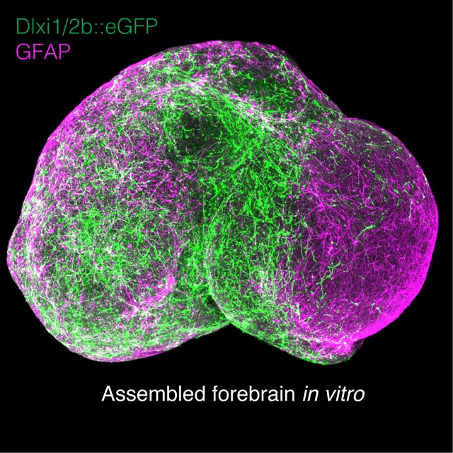 ヒトの前脳に類似した三次元的スフェロイドを、腹側前脳領域（左側）と背側前脳領域（右側）とで別々に作製し、合体させたもの。介在ニューロン（緑色）が腹側前脳から発生中の皮質（背側前脳）へと広がっていく様子が見て取れる。