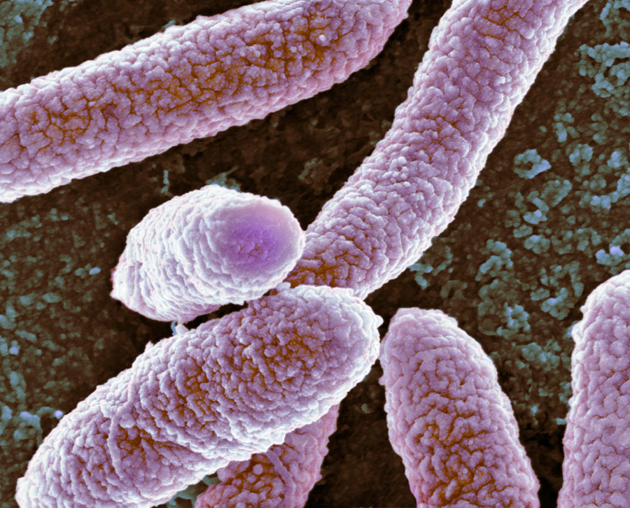 大腸菌の走査型電子顕微鏡画像。