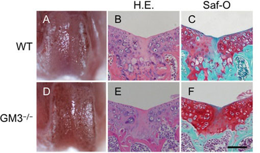 ガングリオシドの欠損はマウスにおいて関節軟骨の修復を亢進する