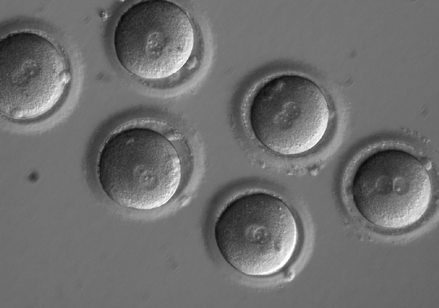 遺伝性心筋症の原因となる遺伝子変異を遺伝子編集によって修正したヒト胚。