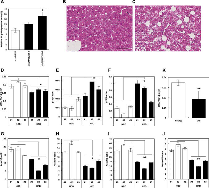 SMARCD1は肝細胞老化に付随する脂質蓄積を制御する