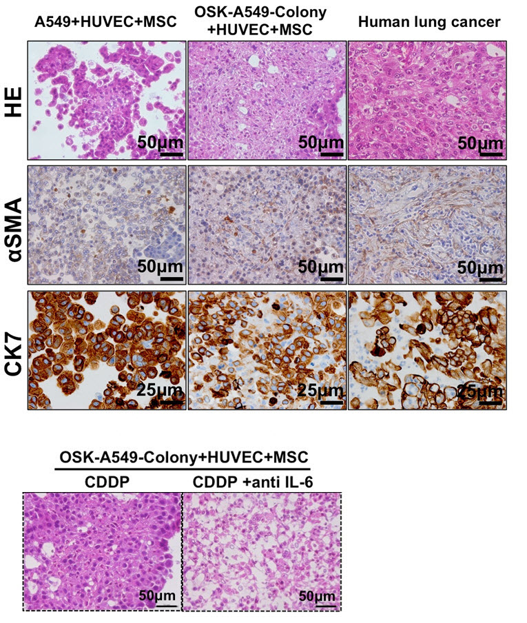 インターロイキン-6阻害は癌幹細胞によって統合される肺癌組織構築を弱体化する