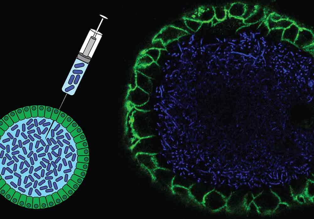オルガノイド内腔に細菌を注入するイメージ図（左）と、実際に細菌を注入したヒト腸オルガノイドの蛍光顕微鏡画像（右）。