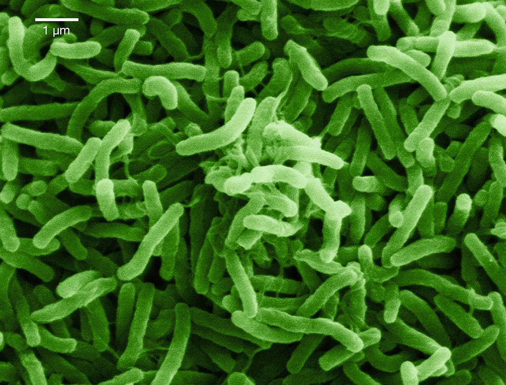 コレラ菌（<i>Vibrio cholerae</i>）の走査型電子顕微鏡画像。
