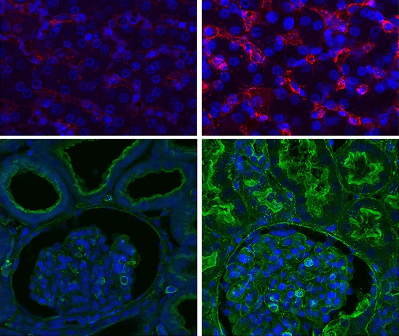 ブタの肝細胞（上）と腎細胞（下）の免疫蛍光染色画像。左側は対照群、右側はOrganExを適用した臓器のもの。OrganEx適用臓器では、組織の完全性が保たれ一部の細胞機能が回復した。