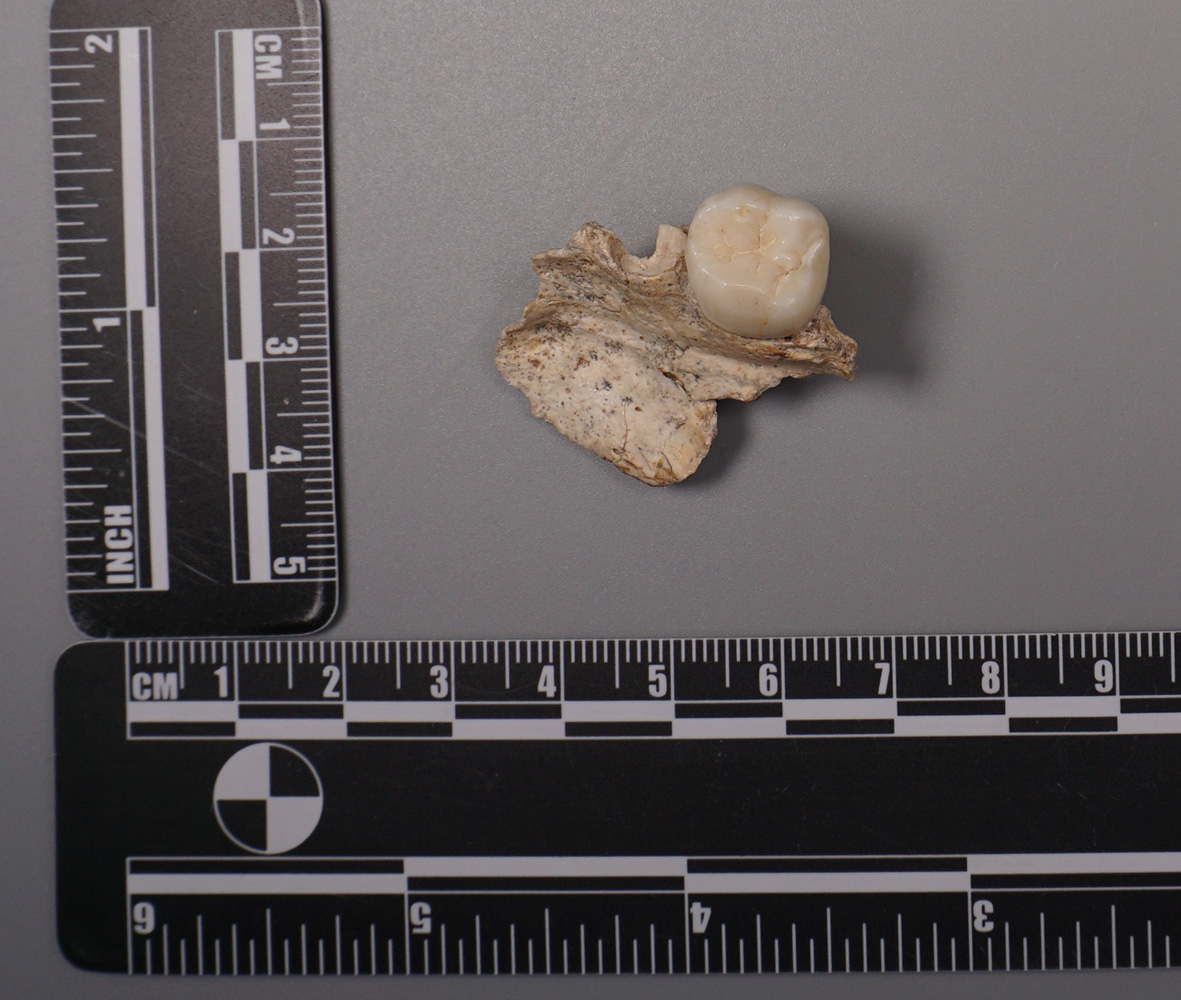 中国の孫家洞遺跡で出土したホモ・エレクトス（<i>Homo erectus</i>）の歯の化石。