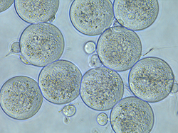 体外受精（IVF）検査の様子。