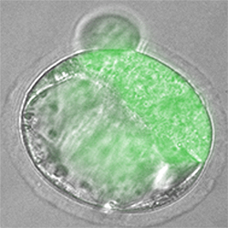 間期の2細胞期マウス胚にOct4-GPFを持つドナー核を移植して得られた胚盤胞。