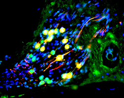 ヒト胚性幹細胞から分化した、スナネズミの蝸牛内の耳ニューロン。