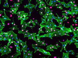 miRNAにより増殖が促進された新生仔ラットの培養心筋細胞。緑色はすべての心筋細胞、赤色は複製中の心筋細胞、青色はすべての核を表す。