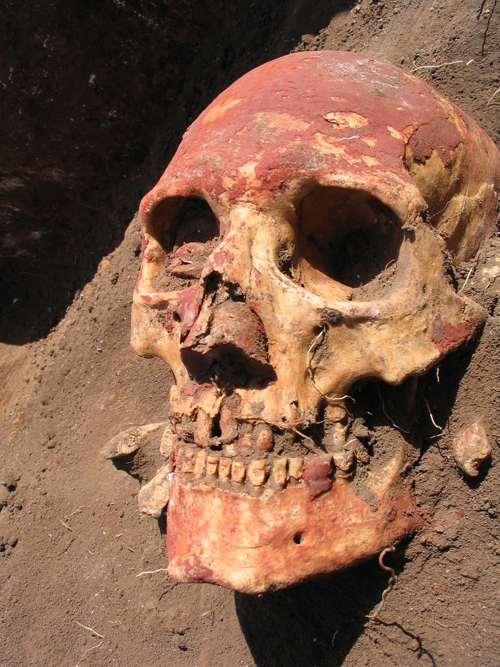 ロシア・サマーラ地域で発見されたヤームナヤ文化人の頭蓋骨。
