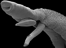雌雄抱合したマンソン住血吸虫の走査型電子顕微鏡写真。