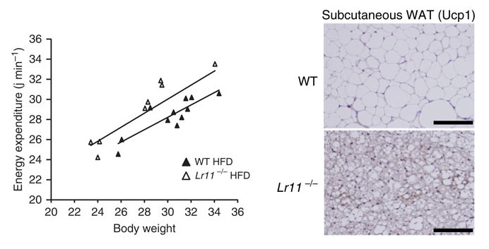 可溶性LR11/SorLAは脂肪組織において熱産生を抑制し、ヒトではBMIと相関する