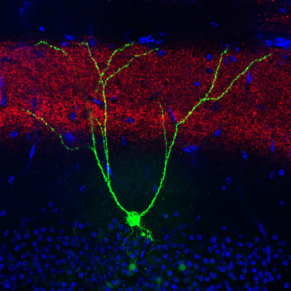 初期アルツハイマー病モデルマウスの海馬歯状回記憶エングラム細胞（緑色）。この細胞への内側嗅内皮質（赤色）からの入力を光刺激によって増強すると、記憶が回復することが分かった。