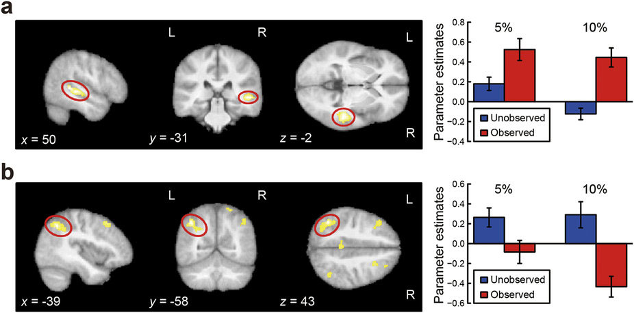 他人に見られるとあがるのはなぜ？：観衆の存在は下頭頂皮質を介して運動パフォーマンスに影響する