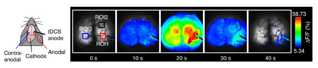 経頭蓋直流電気刺激が誘発するマウス脳可塑性へのグリア細胞の関与をCa<sup>2+</sup>イメージング法で解明