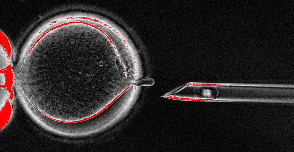 ヒトの卵母細胞から紡錘体を取り出しているところ。