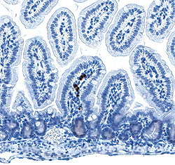 腸管粘膜切片の免疫組織化学染色。茶色の部分がTdT+プロB細胞。
