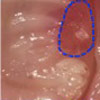 口腔粘膜上皮がもつ「温度を感知するチャネル」が、 口内の傷を早く治していた！