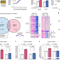 ミトコンドリアのリポイル化が褐色脂肪熱産生の加齢に伴う低減を統合する