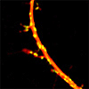 発達中の介在ニューロンの樹状突起でLIS1に依存して起こる、興奮性シナプスの逆行性の移動