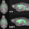 統合失調症モデルとしてのZic2低発現変異マウスと統合失調症患者に見られるZIC2の変異