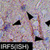 転写因子IRF5は神経性障害性疼痛を引き起こすP2X4R+反応性ミクログリアを駆動する