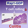 Rap1の2つの機能がT細胞の恒常性を維持し大腸炎の発症を抑制している