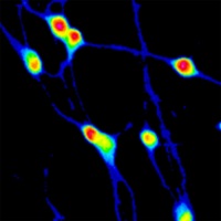 転写因子をコードするmRNAによるヒト多能性幹細胞の神経細胞への迅速な分化
